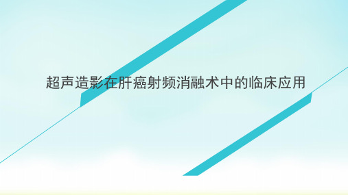 超声引导下射频消融治疗