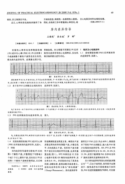 房内差异传导