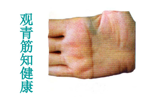 3手诊-青筋篇