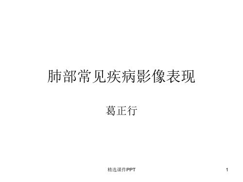 肺部常见疾病影像表现ppt课件