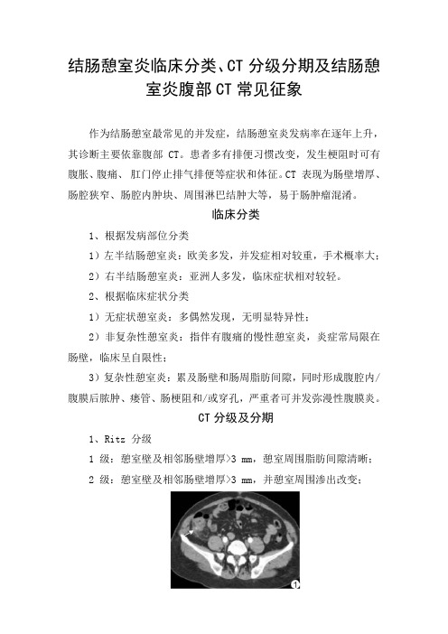 结肠憩室炎临床分类、CT分级分期及结肠憩室炎腹部CT常见征象