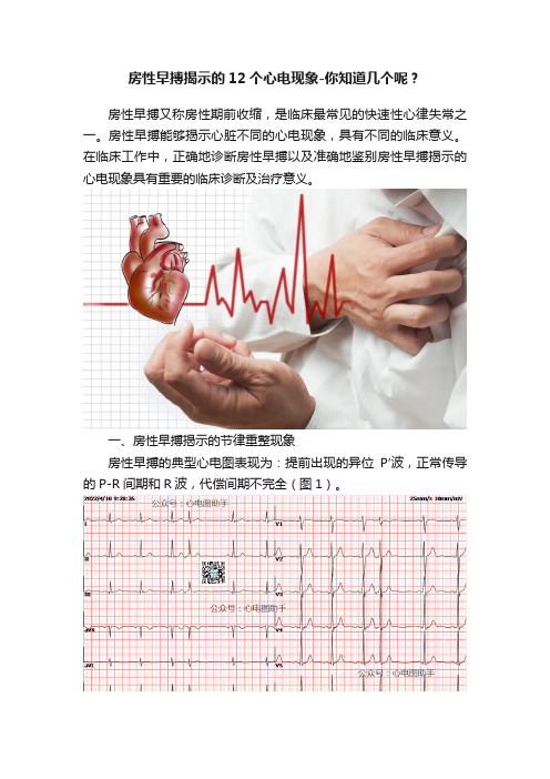 房性早搏揭示的12个心电现象-你知道几个呢？