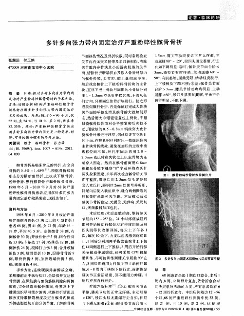 多针多向张力带内固定治疗严重粉碎性髌骨骨折