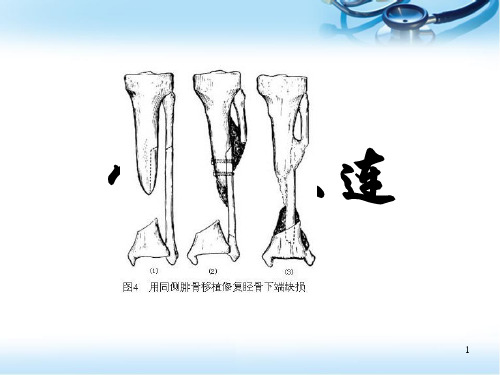 (医学课件)骨不连PPT幻灯片