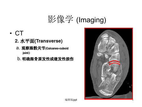 跟骨骨折影像学ppt课件