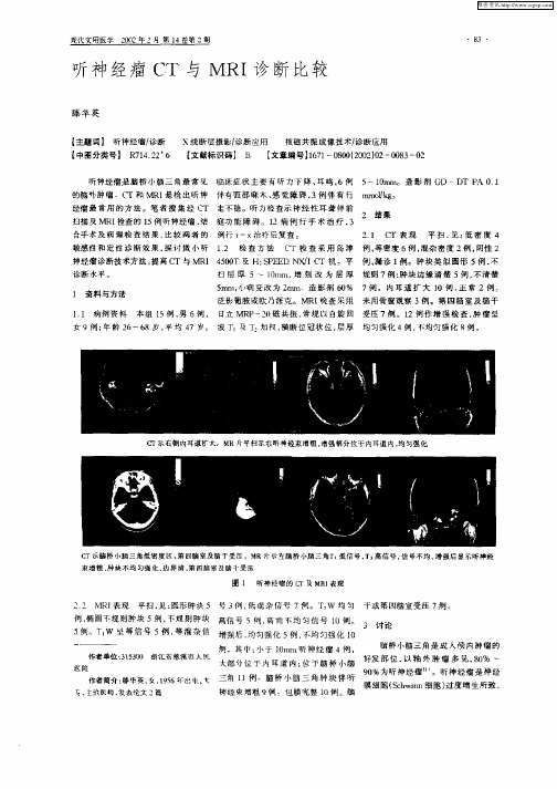 听神经瘤CT与MRI诊断比较