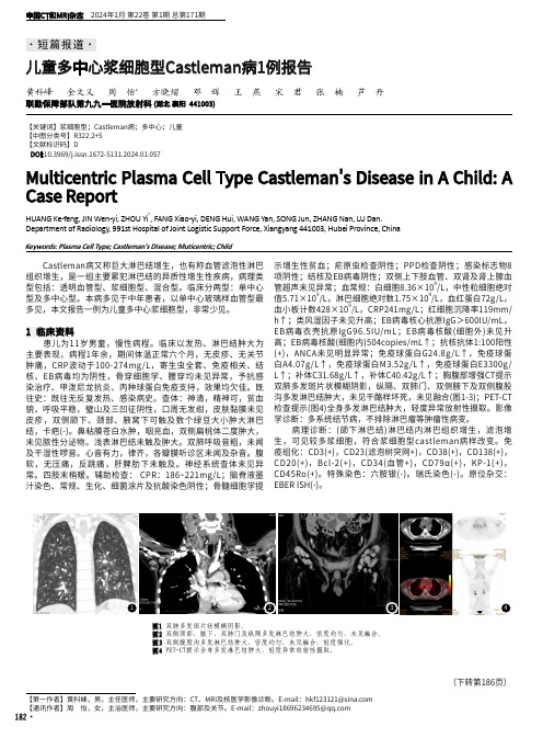 儿童多中心浆细胞型Castleman病1例报告