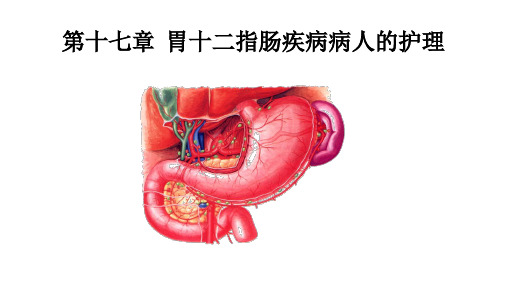 胃十二指肠疾病病人的护理 PPT课件