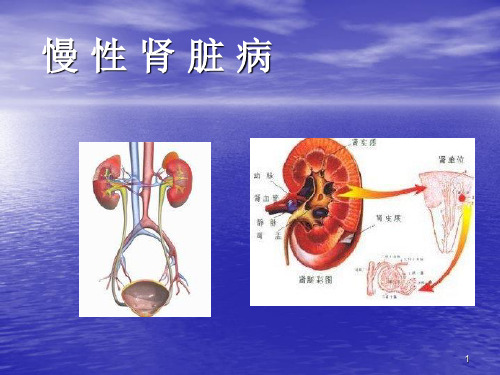 慢性肾脏病PPT课件