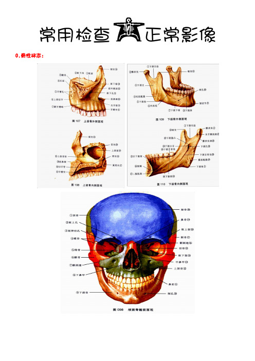 口腔颌面影像诊断常见图谱