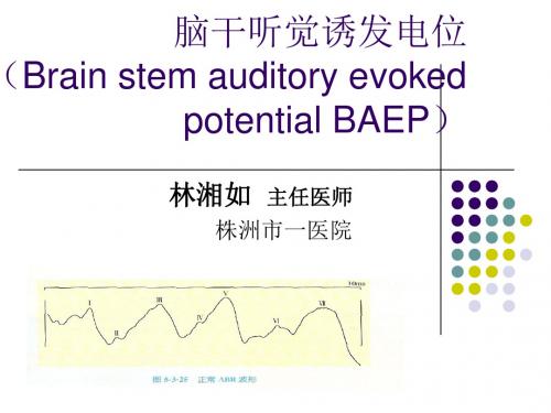 脑干听觉诱发电位