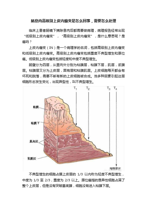 肠息肉高级别上皮内瘤变是怎么回事，需要怎么处理