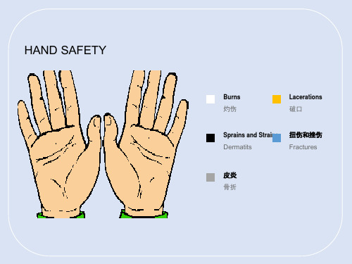手部防护安全培训