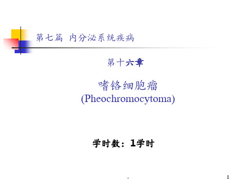 嗜铬细胞瘤(1)PPT课件