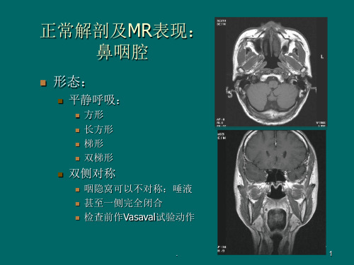 鼻咽癌MR诊断