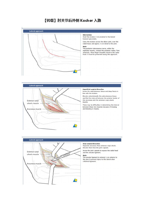 【转载】肘关节后外侧Kocher入路