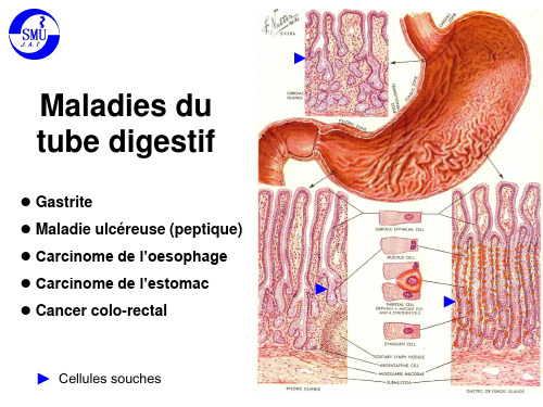 医学消化系统课件：Maladies du tube digestif_1