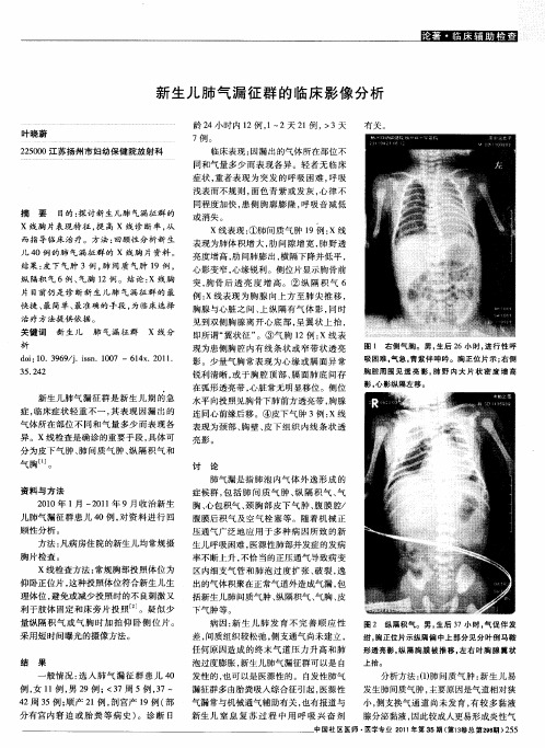 新生儿肺气漏征群的临床影像分析