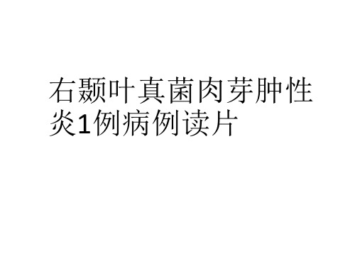 右颞叶真菌肉芽肿性炎1例病例读片PPT