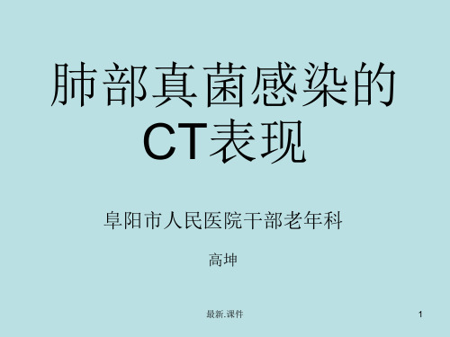 肺部真菌感染的CT表现完整版.ppt