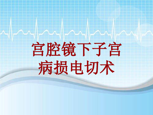 手术讲解模板：宫腔镜下子宫病损电切术