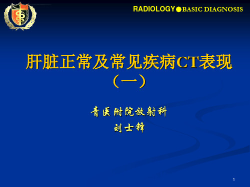 肝脏正常及常见疾病CT表现一ppt课件