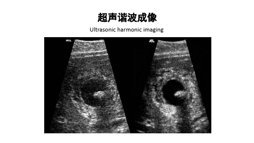 超声谐波成像