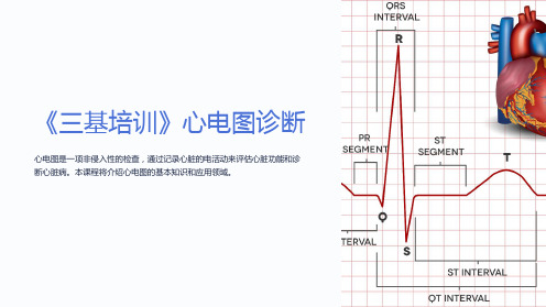 《三基培训》心电图诊断