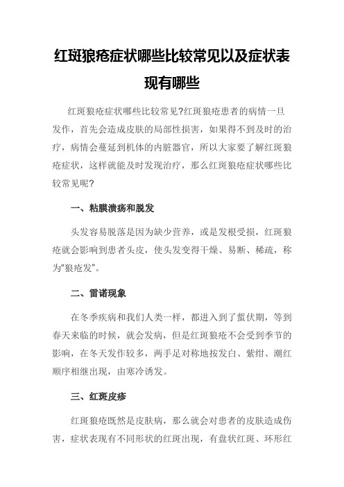 红斑狼疮症状哪些比较常见以及症状表现有哪些