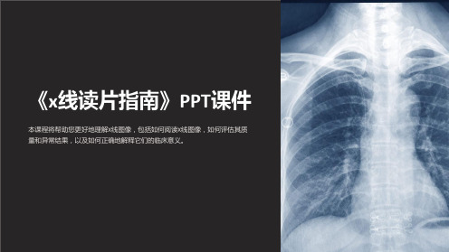 《x线读片指南》课件