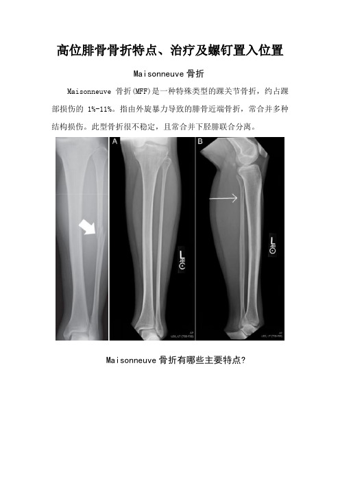 高位腓骨骨折特点、治疗及螺钉置入位置