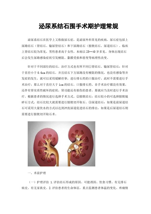 泌尿系结石围手术期护理常规