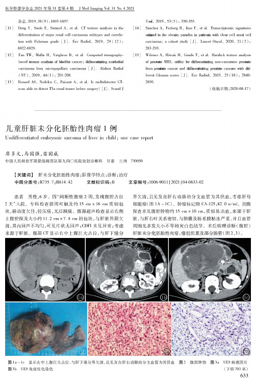 儿童肝脏未分化胚胎性肉瘤1例