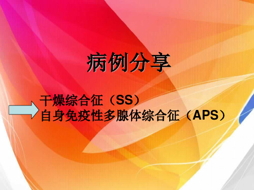 干燥综合征 SS 与自身免疫性多腺体综合征 APS 