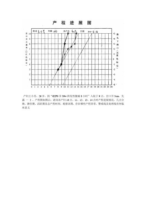 产程进展图