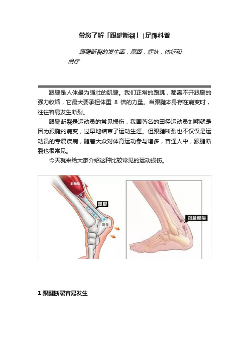 带您了解「跟腱断裂」∣足踝科普