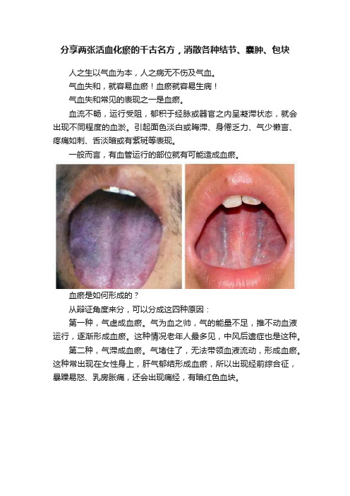 分享两张活血化瘀的千古名方，消散各种结节、囊肿、包块