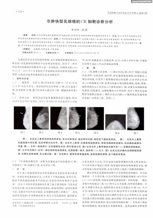 非肿块型乳腺癌的CR钼靶诊断分析