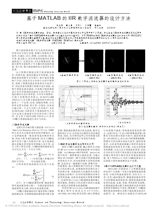 基于MATLAB的IIR数字滤波器的设计方法