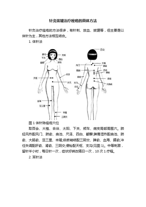 针灸拔罐治疗痤疮的具体方法