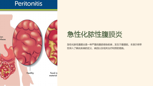 急性化脓性腹膜炎