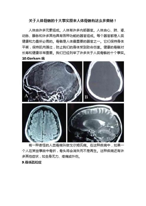 关于人体骨骼的十大事实原来人体骨骼有这么多奥秘！