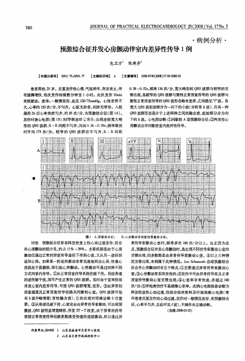 预激综合征并发心房颤动伴室内差异性传导1例