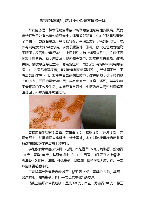 治疗带状疱疹，这几个中医偏方值得一试