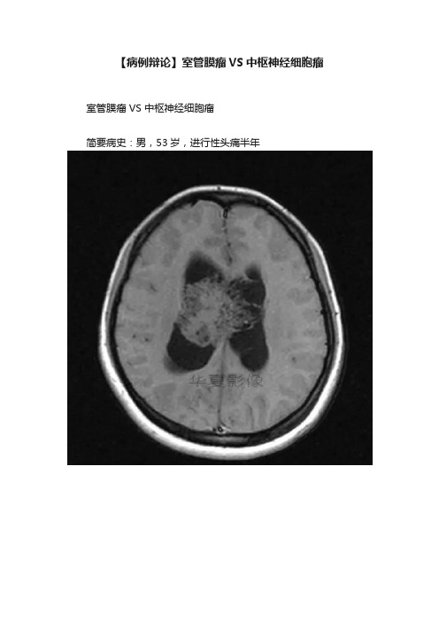 【病例辩论】室管膜瘤VS中枢神经细胞瘤