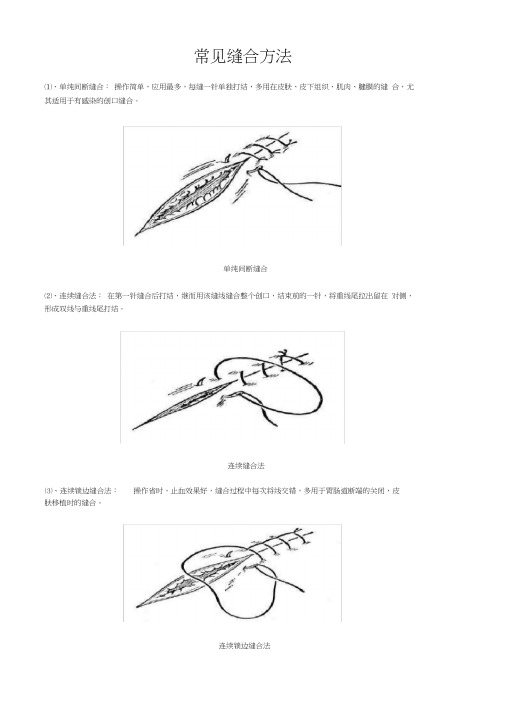 常见缝合方法