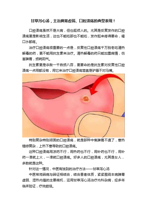 甘草泻心汤，主治脾胃虚弱、口腔溃疡的典型表现！