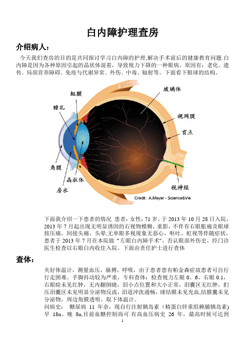 白内障护理查房