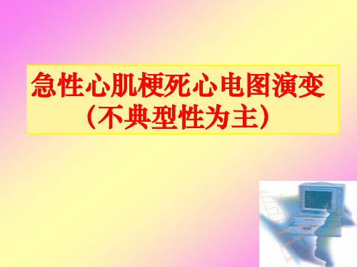 急性心肌梗死心电图演变