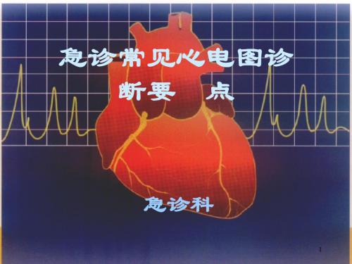 急诊常见心电图诊断要点ppt课件